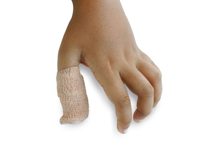 10 Symptoms and Treatments of Mallet Finger