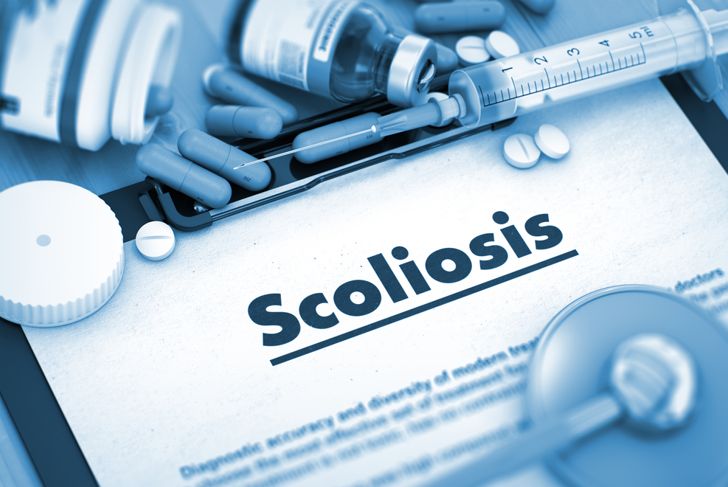 10 Symptoms of Scoliosis