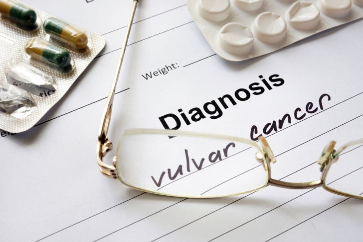 10 Symptoms of Vulvar Cancer