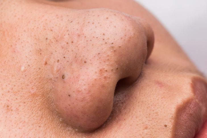 16 Things Dermatologists Want You To Know About Your Skin