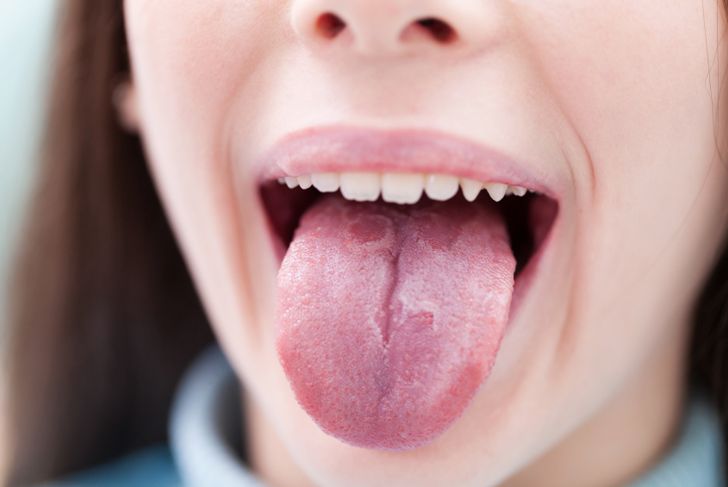 7 Things Your Tongue Says About Your Health