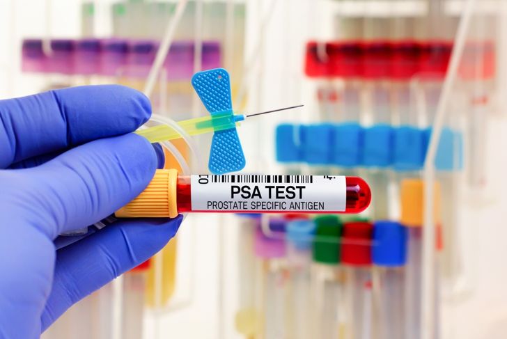 Common Screening Tests for Disease
