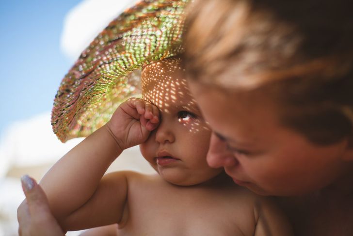 Heat Rash in Infants and Children