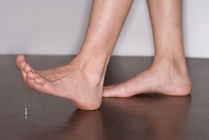 How Does Peripheral Neuropathy Affect Feet?