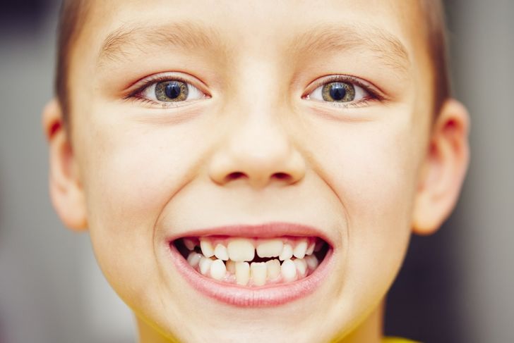 Signs Your Child May Need Braces