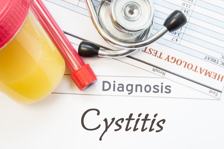 Symptoms of Interstitial Cystitis