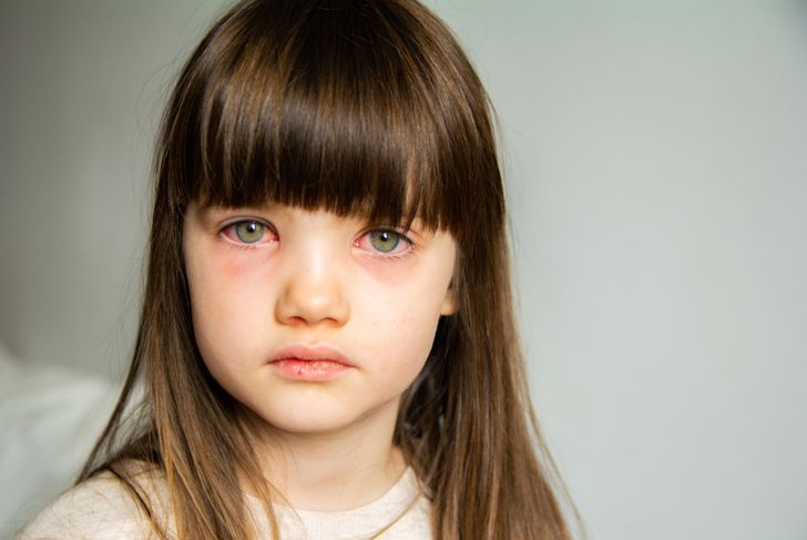 The Most Common Childhood Illnesses