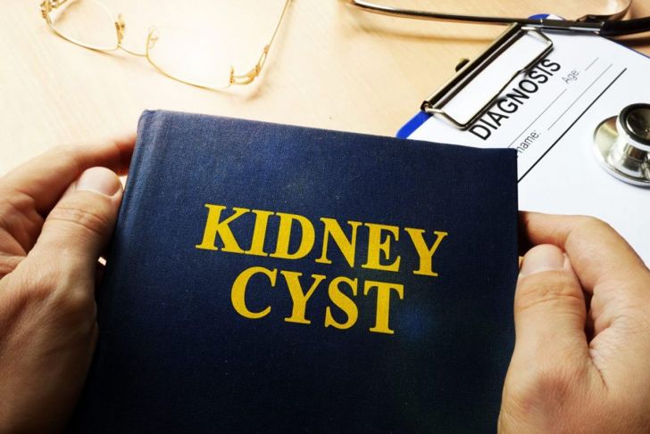 Treatments for Kidney Cysts