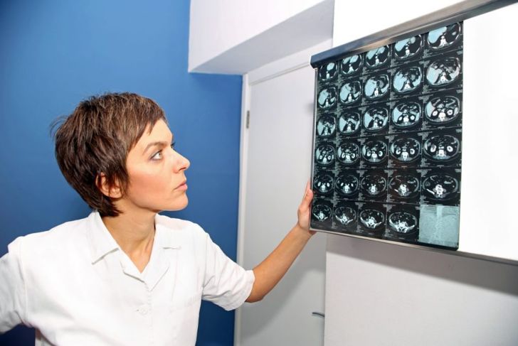 Treatments for Kidney Cysts