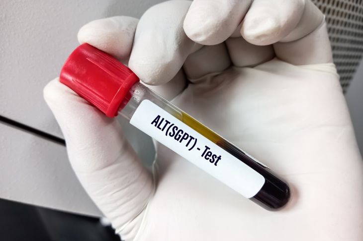 Understanding ALT Blood Tests and Their Results