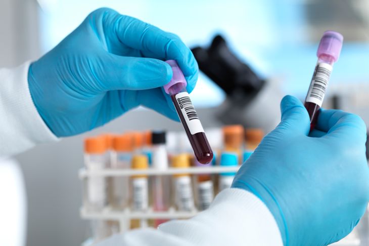 Understanding ALT Blood Tests and Their Results