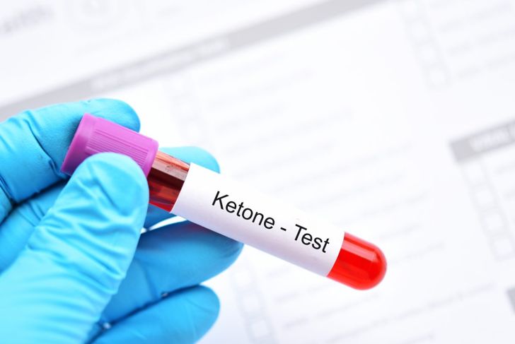 What Are Ketones and Why Do They Matter?