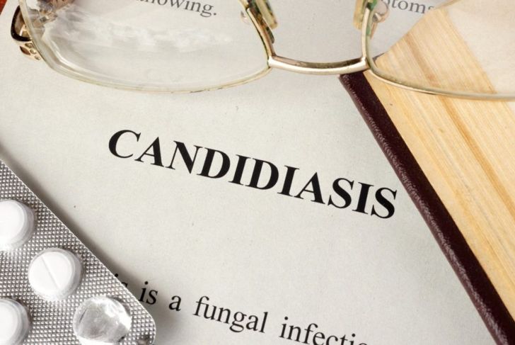 What You Should Know About the Candida Diet