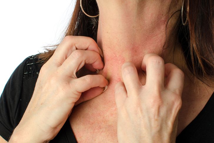 10 Causes and Triggers of Eczema