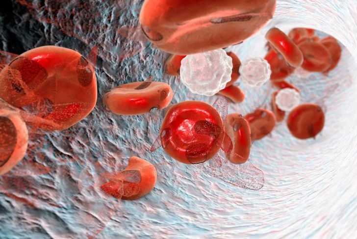 10 Causes of Anemia