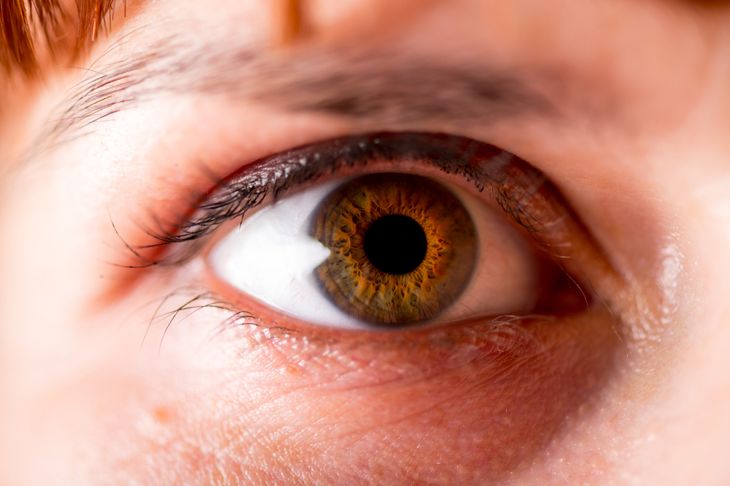 10 Causes of Glaucoma