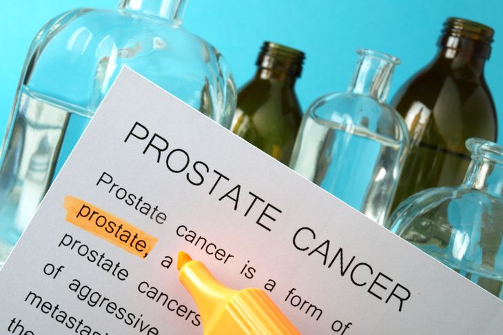 10 Causes of Prostate Cancer