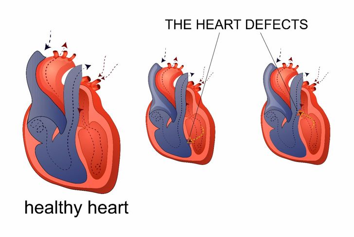10 Causes of Pulmonary Arterial Hypertension