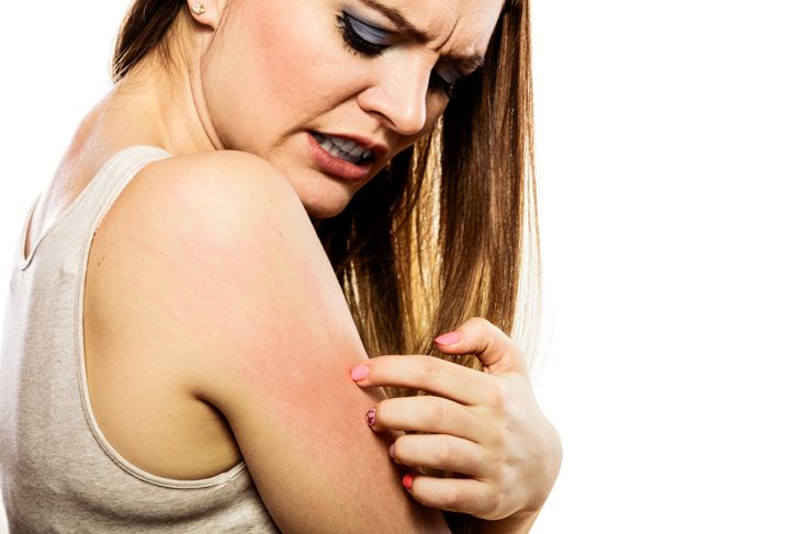 10 Causes of Ringworm