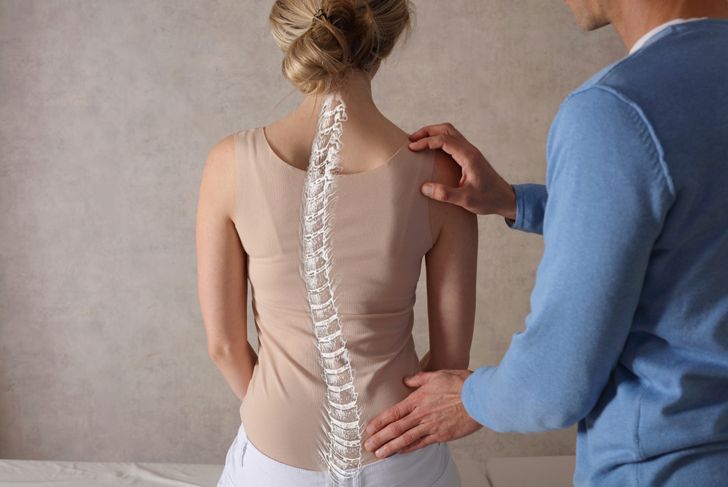 10 Causes of Scoliosis