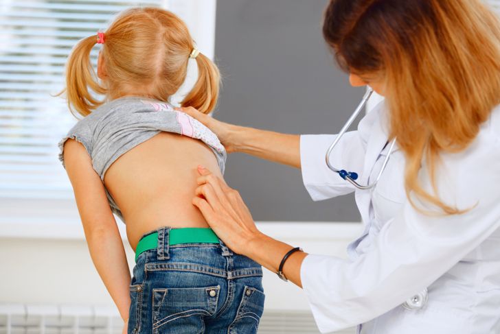 10 Causes of Scoliosis