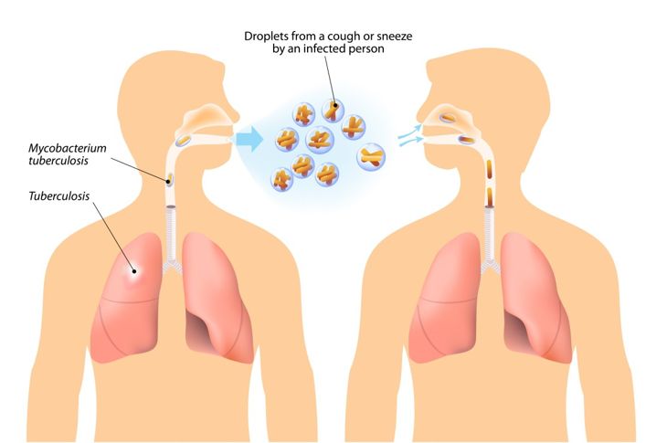 10 Causes of the Common Cough