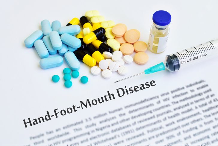 10 Causes, Symptoms, and Treatments of Hand-Foot-and-Mouth Disease