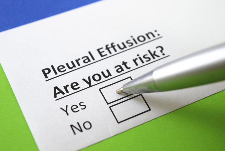 10 Causes, Symptoms, and Treatments of Pleural Effusion