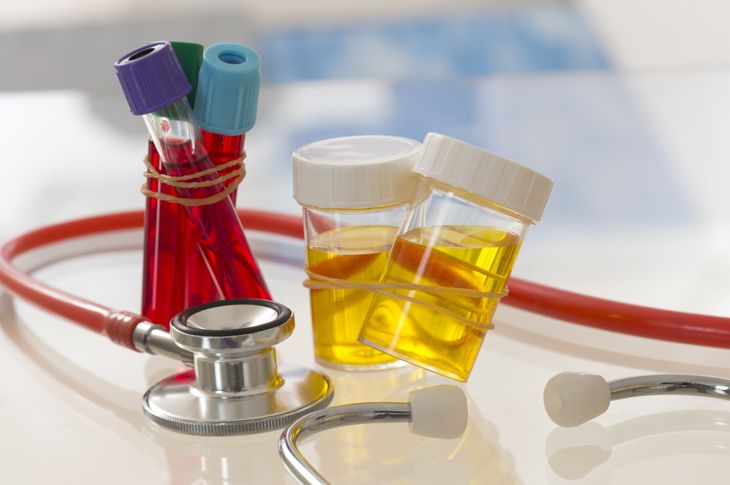 10 FAQs about Blood in Urine