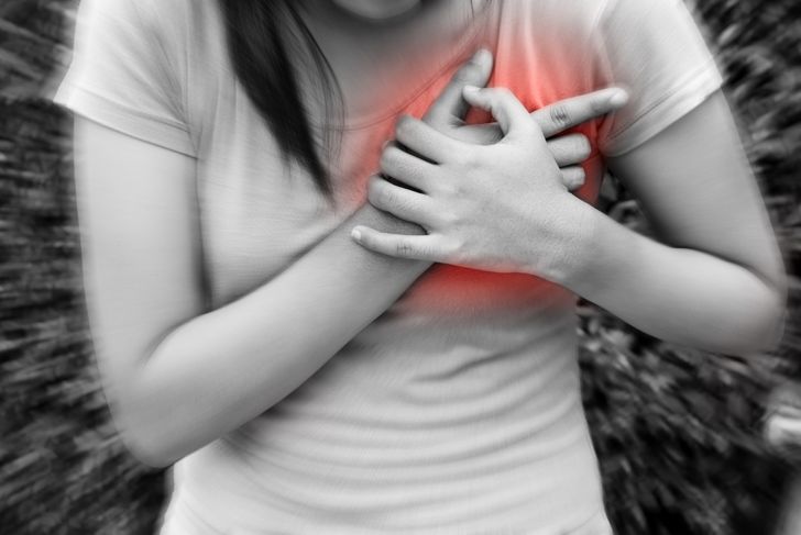 10 Frequently Asked Questions About Acute Myocardial Infarction