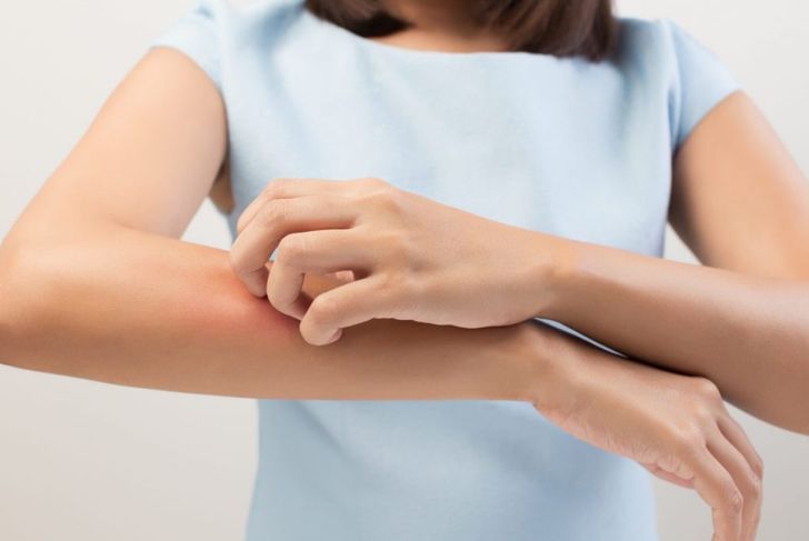 10 Frequently Asked Questions About Erythema Nodosum
