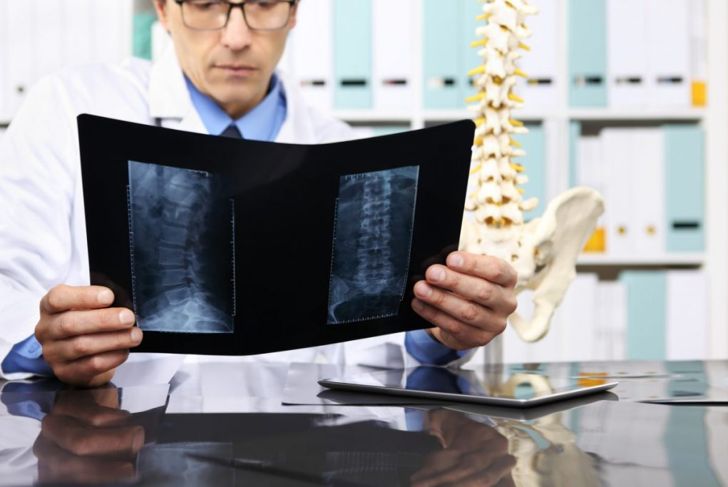 10 Frequently Asked Questions About Slipped Discs