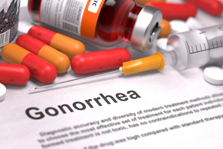10 Not-So-Embarrassing Facts About Gonorrhea