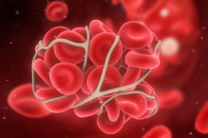 10 Signs Of a Blood Clot