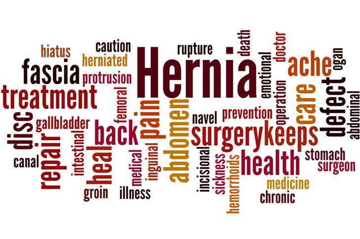 10 Signs of a Hernia