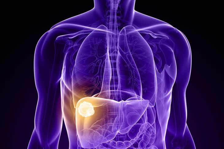 10 Signs of Liver Cancer