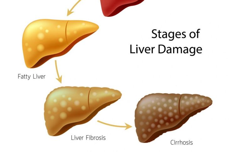 10 Signs of Liver Damage