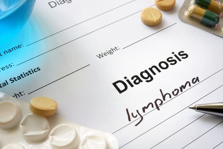 10 Signs of Lymphoma
