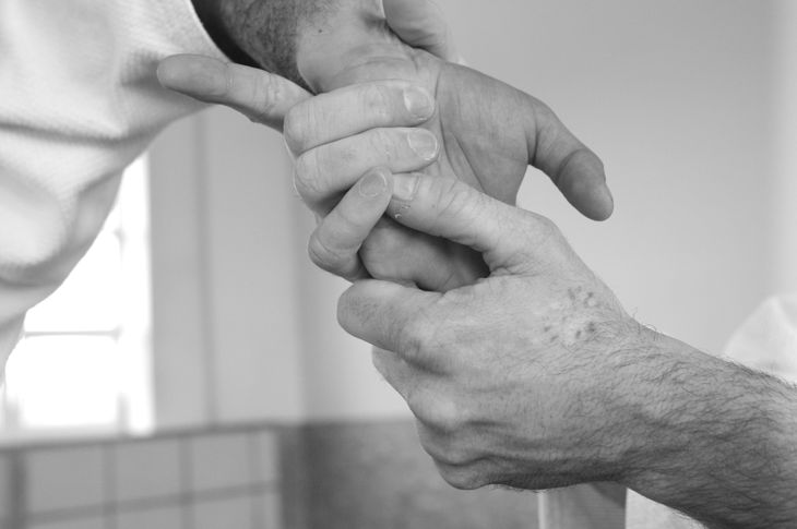 10 Signs of Rheumatoid Arthritis