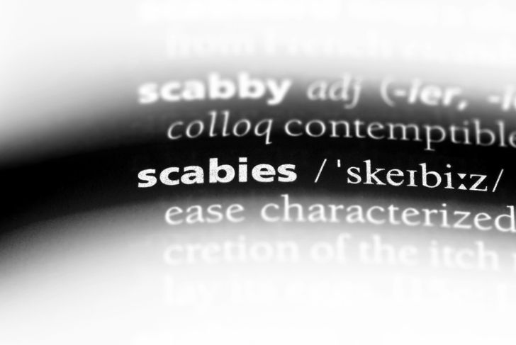 10 Signs of Scabies