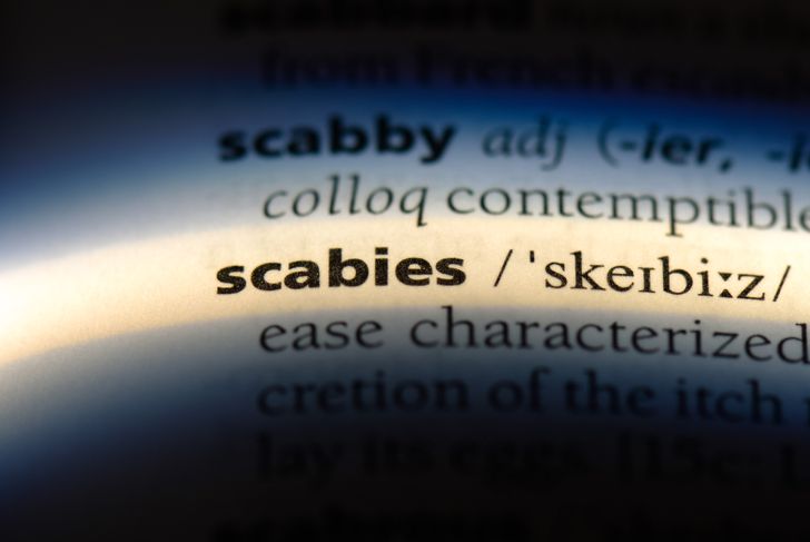 10 Signs of Scabies