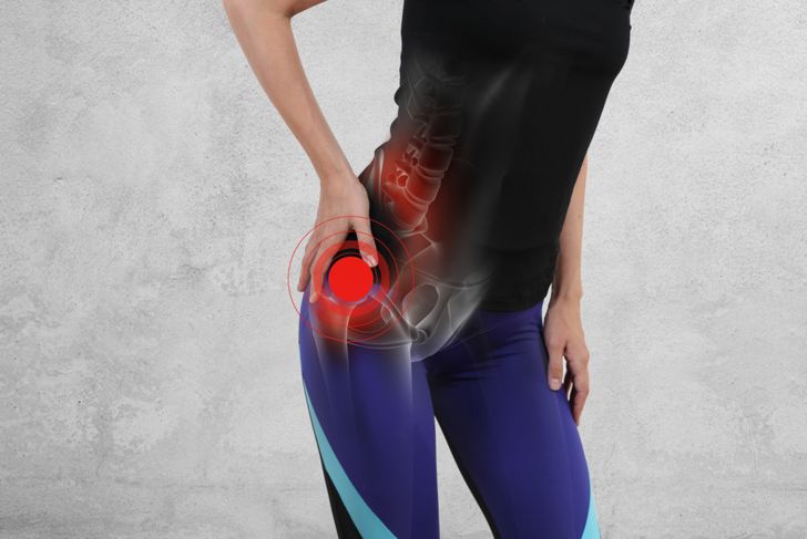 10 Symptoms and Treatments for Bursitis of the Hip