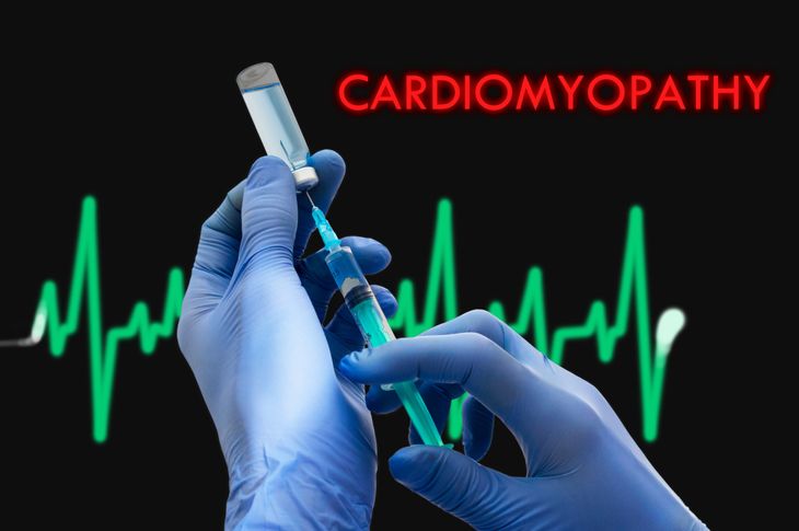 10 Symptoms and Treatments for Cardiomyopathy