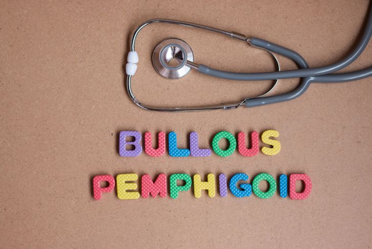 10 Symptoms and Treatments of Bullous Pemphigoid