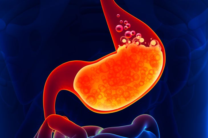 10 Symptoms and Treatments of Gastritis