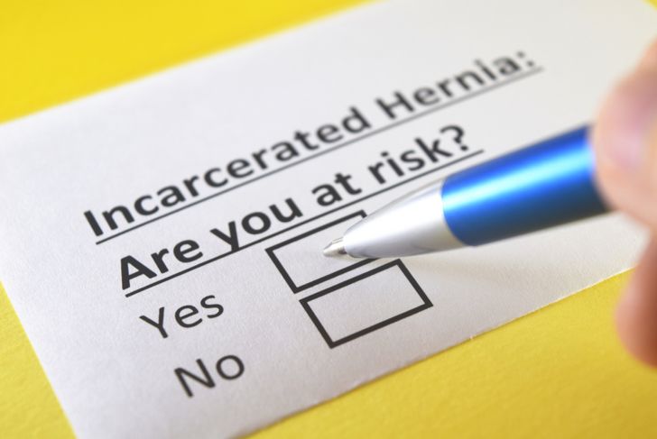 10 Symptoms of a Hiatal Hernia