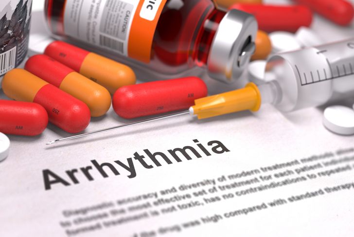 10 Symptoms of Arrhythmia