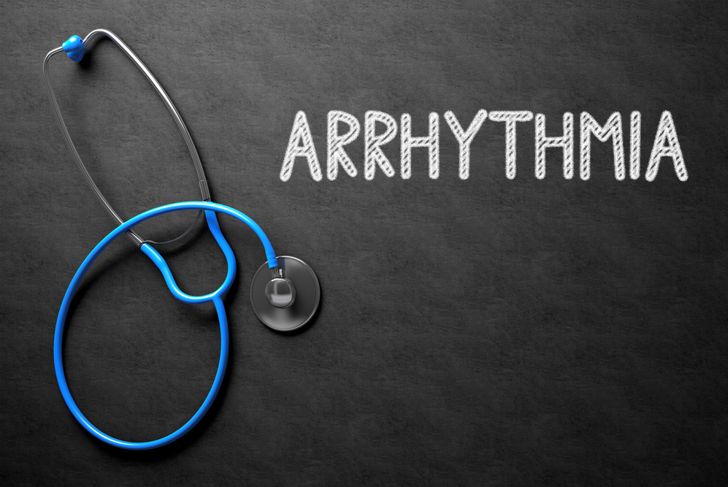 10 Symptoms of Arrhythmia