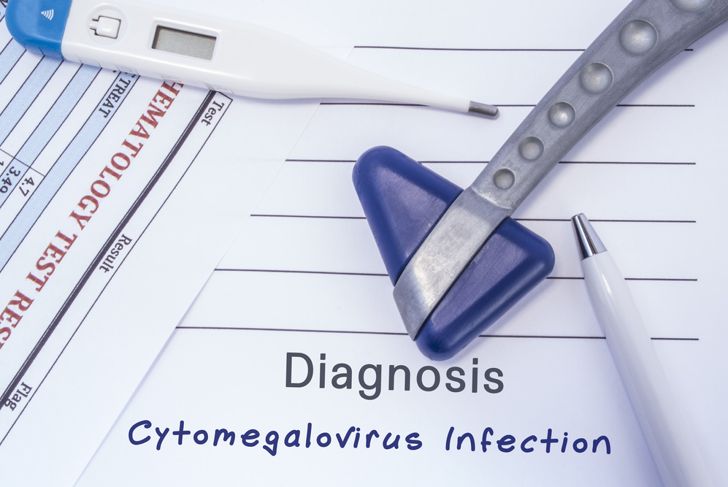 10 Symptoms of Cytomegalovirus (CMV)