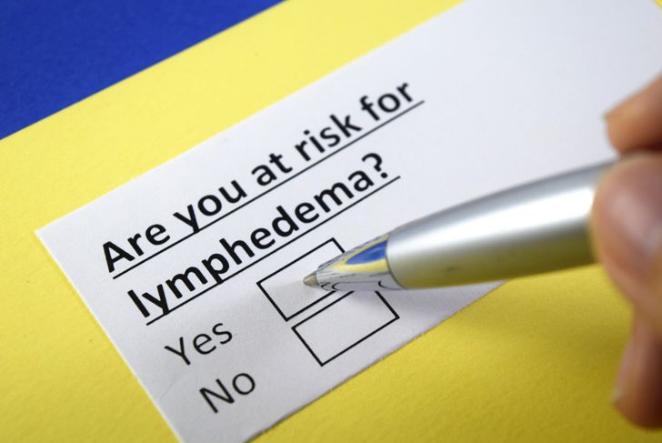 10 Symptoms of Lymphedema